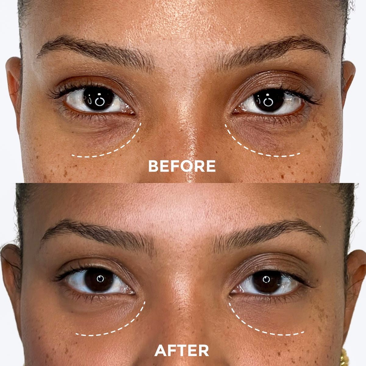 Soin Contour des Yeux au Rétinol – Regard Lissé et Éclatant
