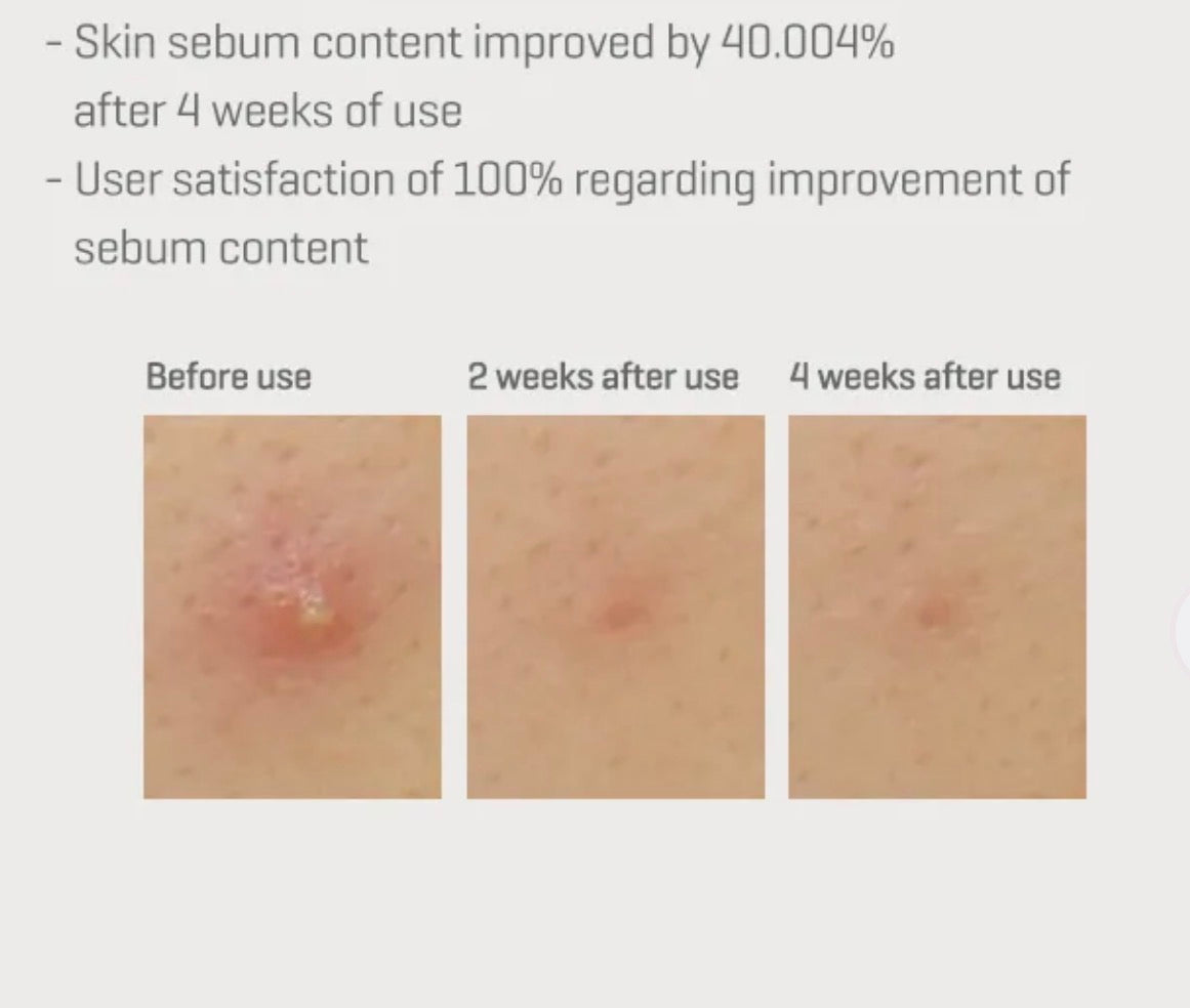 Sérum intense